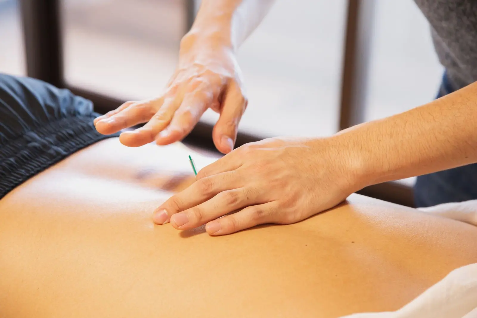 Dry Needling in Boca Raton