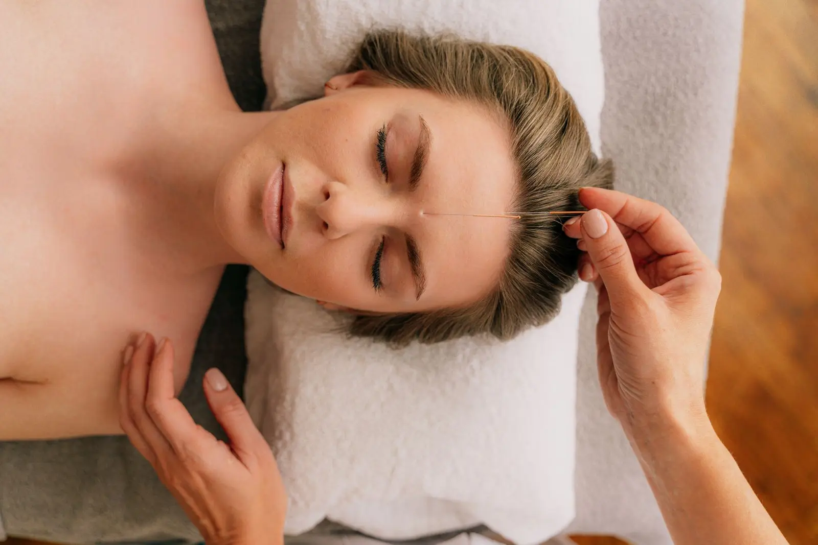 Acupuncture in Boca Raton