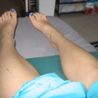 Acupuncture Redefined