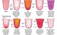 Tongue Diagnosis is a way to see into your body