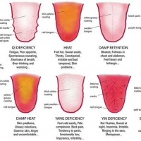 Tongue Diagnosis is a way to see into your body
