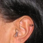 Ear Acu-Magnets